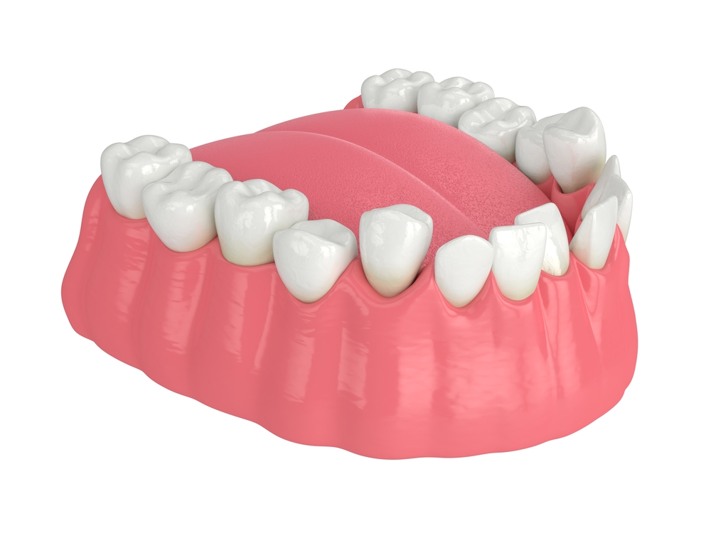Ceramic Crowns in Riyadh 1 Crooked teeth treatment in saudia arabia
