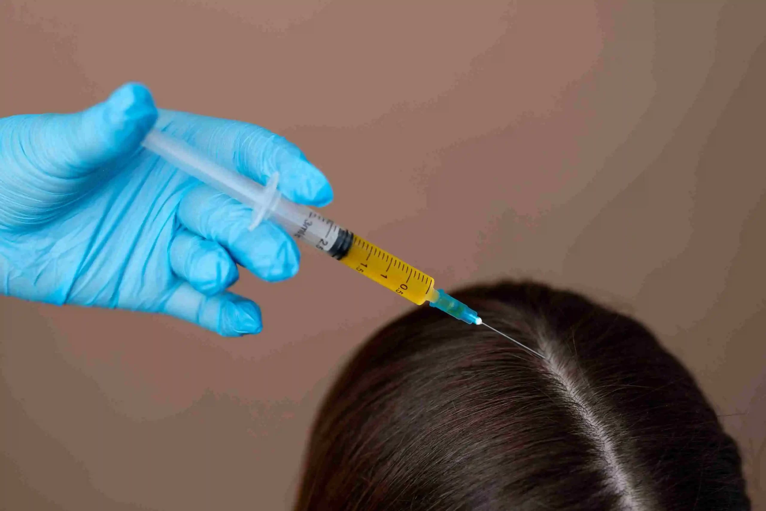 Regenera Activa in Riyadh 3 Acell Injections for Hair Growth in Riyadh