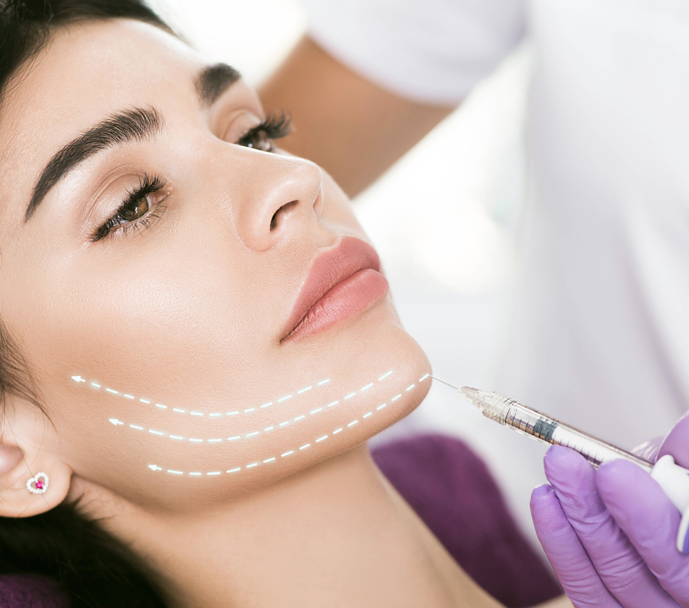 Facelift in Riyadh | Saudia Arabia 1 facelift procedure