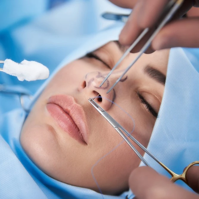 rhinoplasty procedure