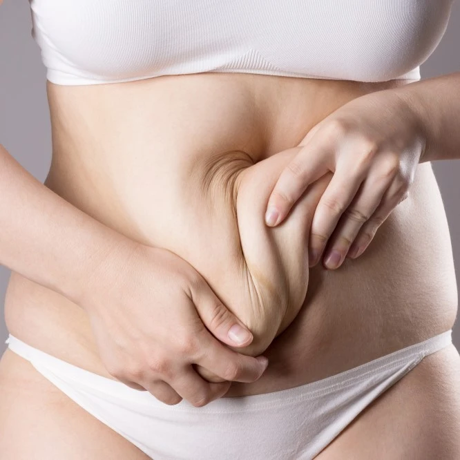Cosmetic Surgery in Riyadh 1 tummy tuck