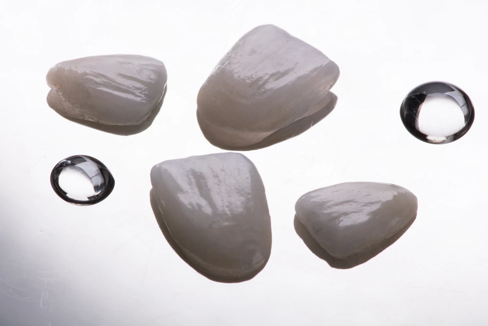 Composite Veneers in Riyadh | Saudi Arabia 1 E Max Veneers how it works