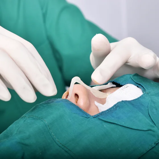 Silicone Nose Surgery in Riyadh 1 silicon nose surgery procedure