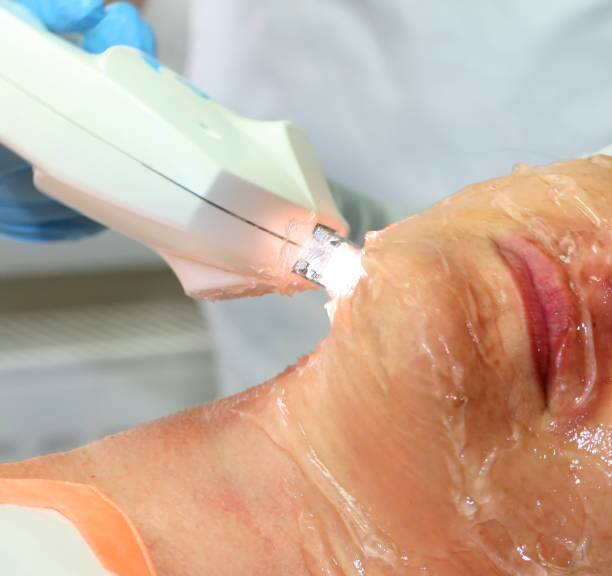 Superficial Chemical Peels in Riyadh 2 Superficial chemical peel procedure