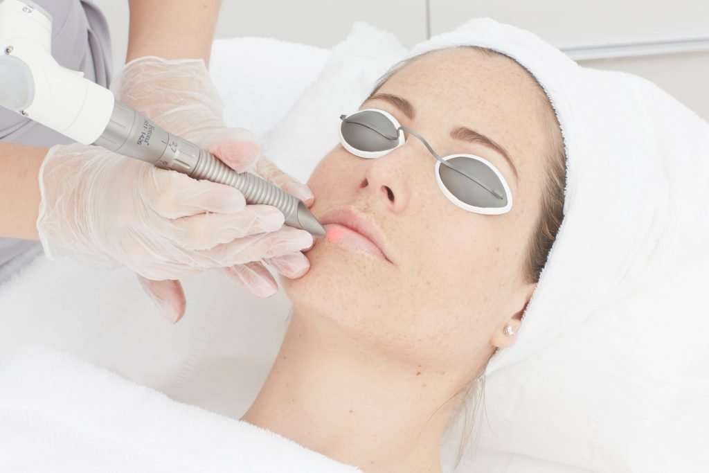 Pico Laser Treatment in Riyadh 1 pico laser treatment procedure