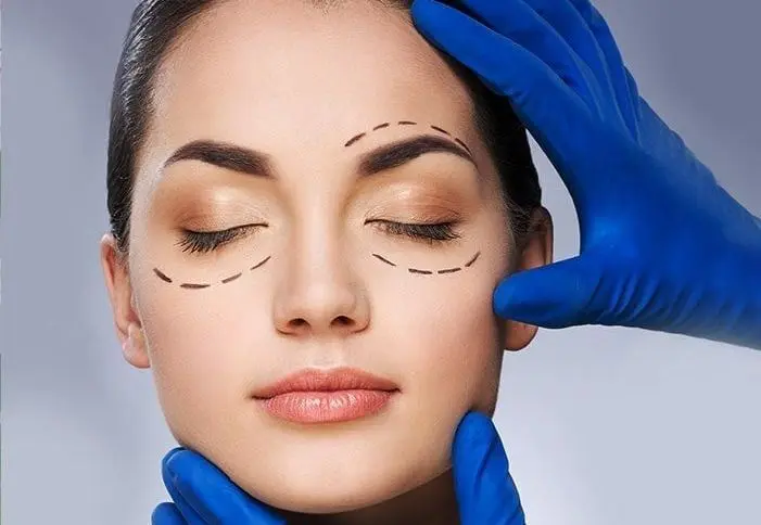 Eyelid Surgery in Riyadh 4 Factors Affecting Eyelid Surgery Cost In Riyadh