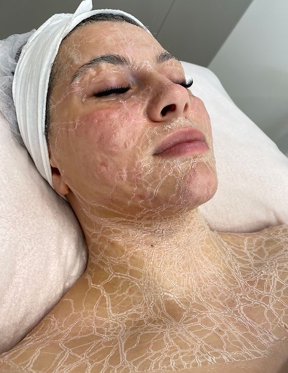 DMK Enzyme Therapy in Riyadh 2 dmk enzyme therapy procedure