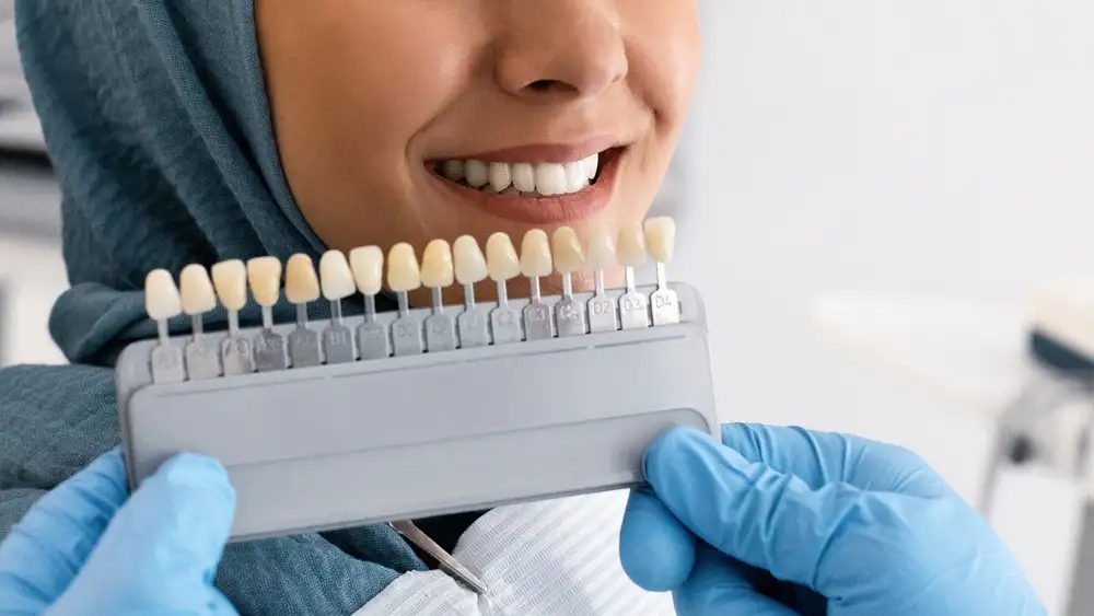 Dental Clinic Riyadh 3 dental veneers in riyadh