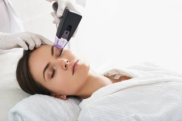Sylfirm Treatment in Riyadh 3 Morpheus8 Treatment in riyadh
