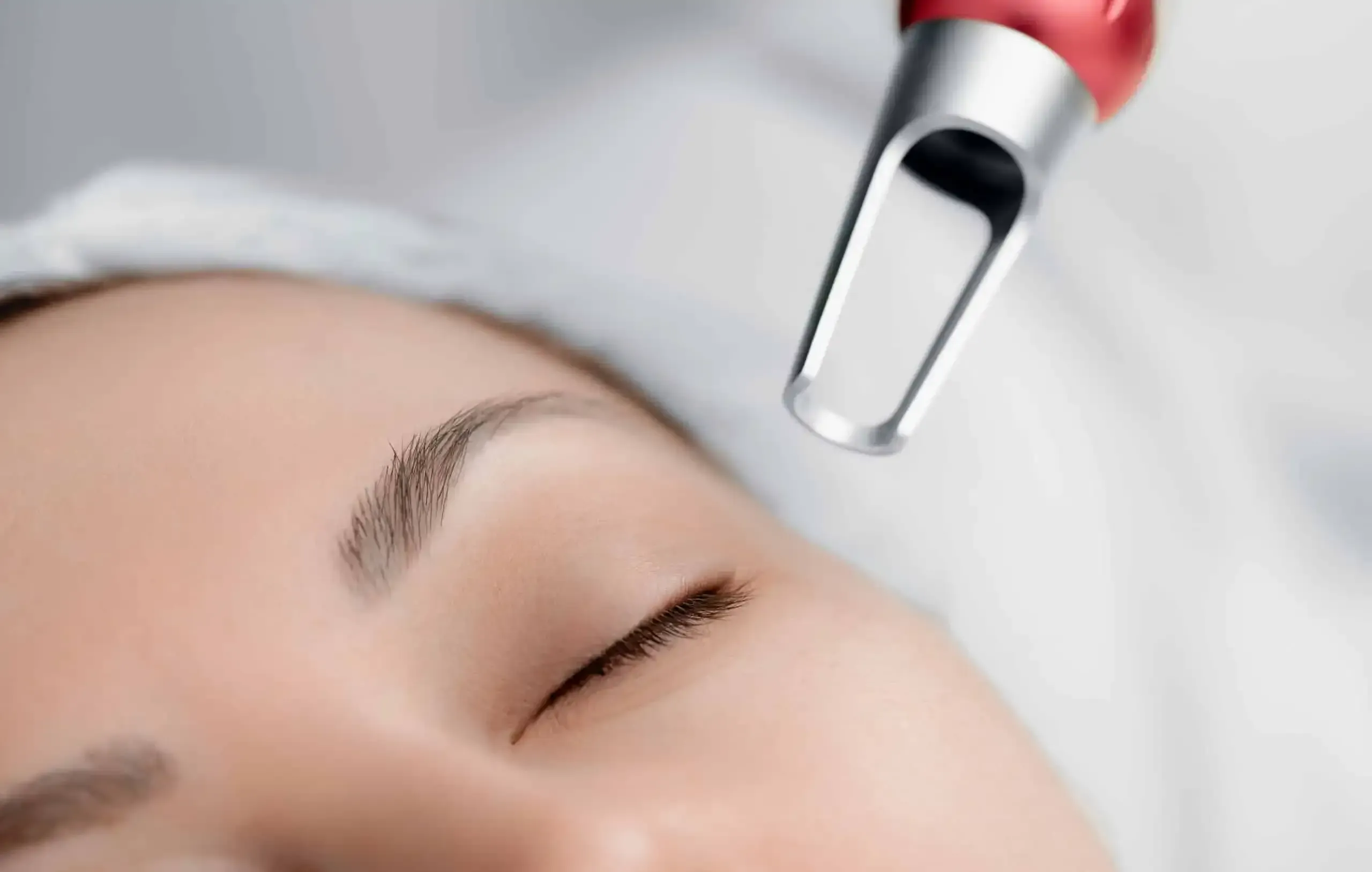 Pico Laser Treatment in Riyadh 5 pico laser cost