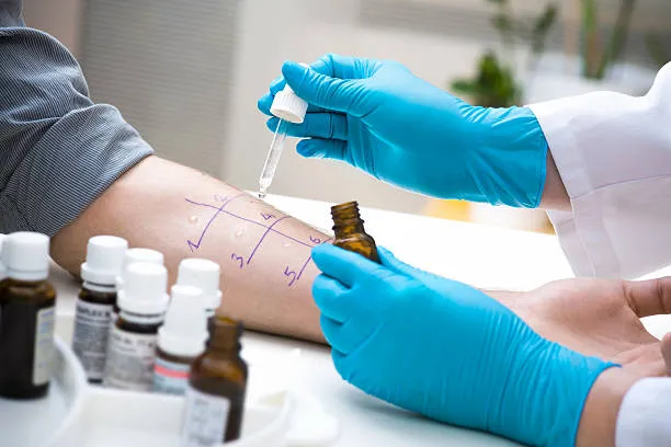 Blood Test for Body Analysis at Home in Riyadh 2 food intolerance and allergy testing in riyadh