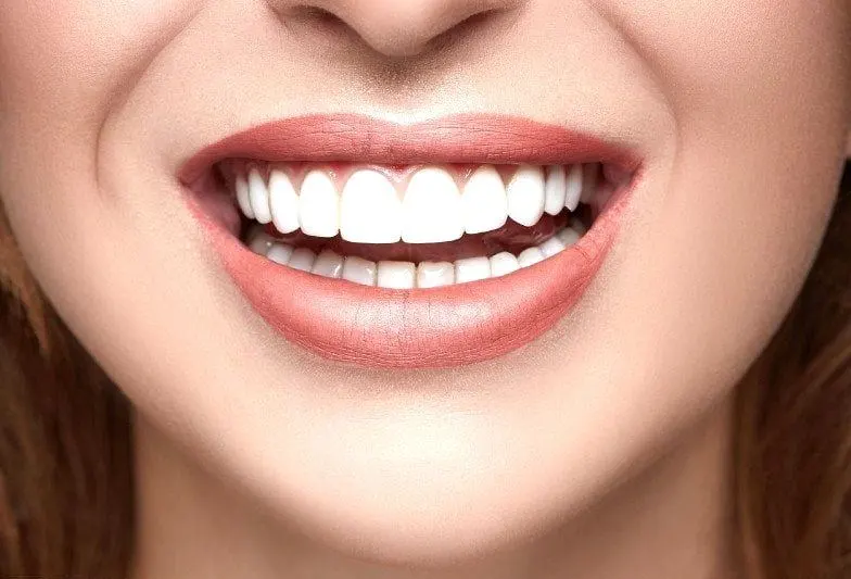 E-Max Veneers in Riyadh | Saudi Arabia 6 Emax Veneers Cost in Riyadh