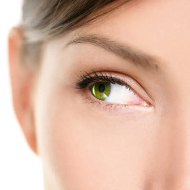 Under Eye Fillers in Riyadh 4 almond eyes in riyadh