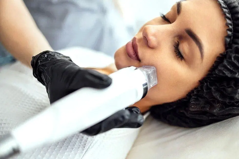 DermaPen in Riyadh 4 Dermapen Vs Traditional Micro Needling; Which Is Right For You