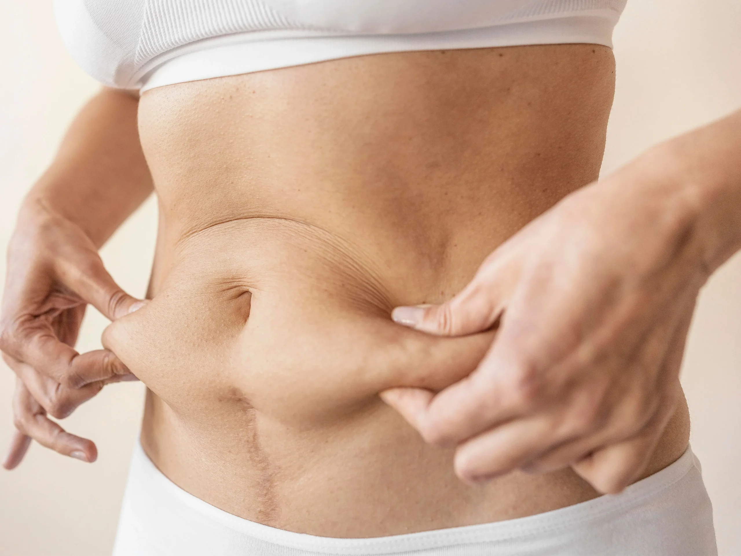 Tummy Tuck in Riyadh 5 tummy tuck cost in riyadh