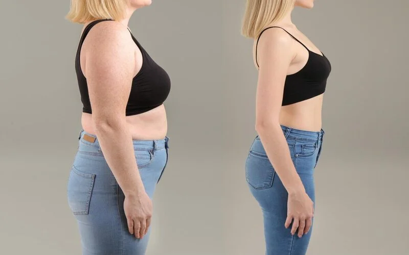 Weight Loss Injections in Riyadh 1 Weght loss injection before and after result