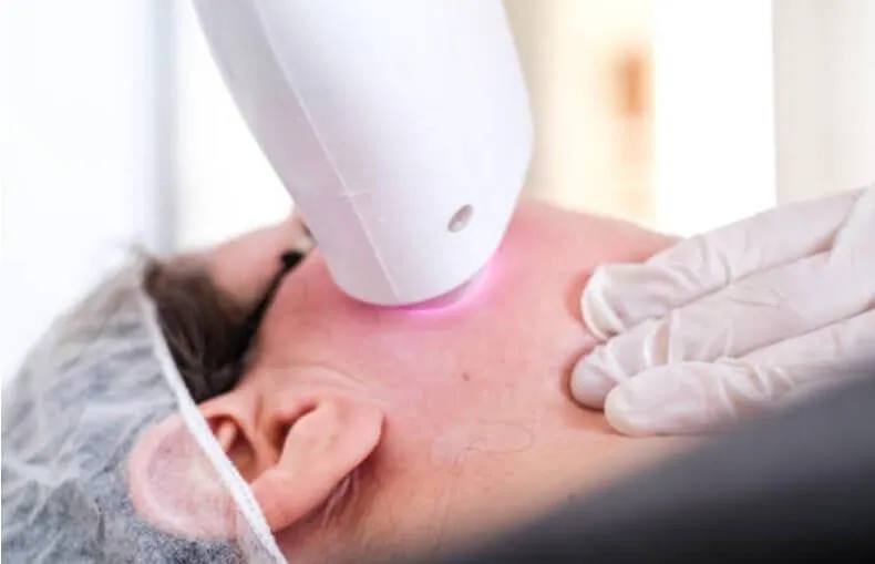 Laser Hair Bleaching in Riyadh 3 Laser Hair Bleaching Cost In Riyadh
