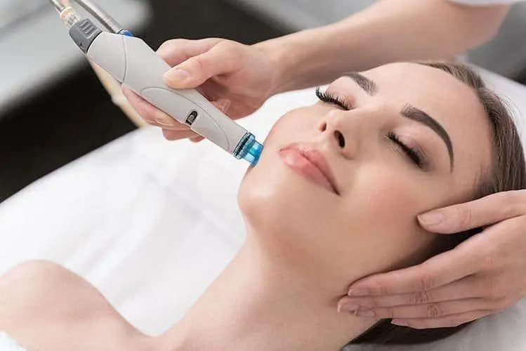 DMK Enzyme Therapy in Riyadh 4 Dermabrasion Treatment in Riyadh