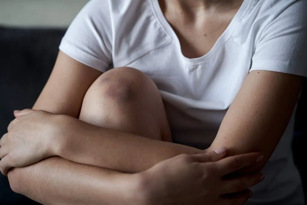 Psoriasis Treatment in Riyadh 4 Hematoma treatment Cost in riyadh