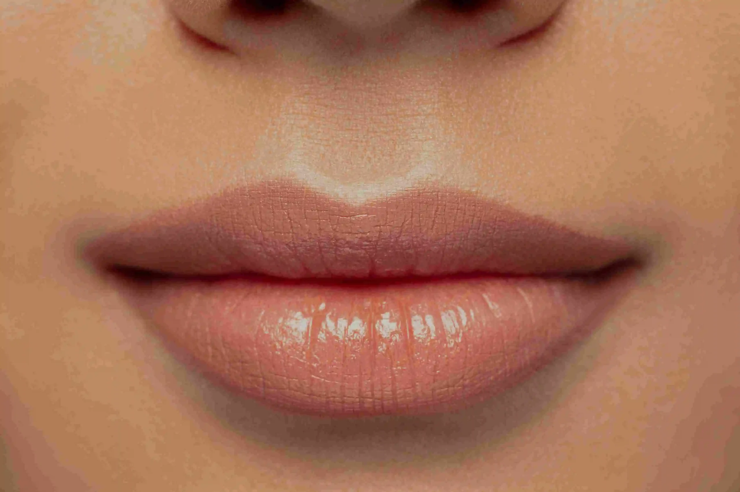 Bullhorn Lip Lift in Riyadh | Saudi Arabia 5 Lip Enlargement Lip Enhancement in Riyadh