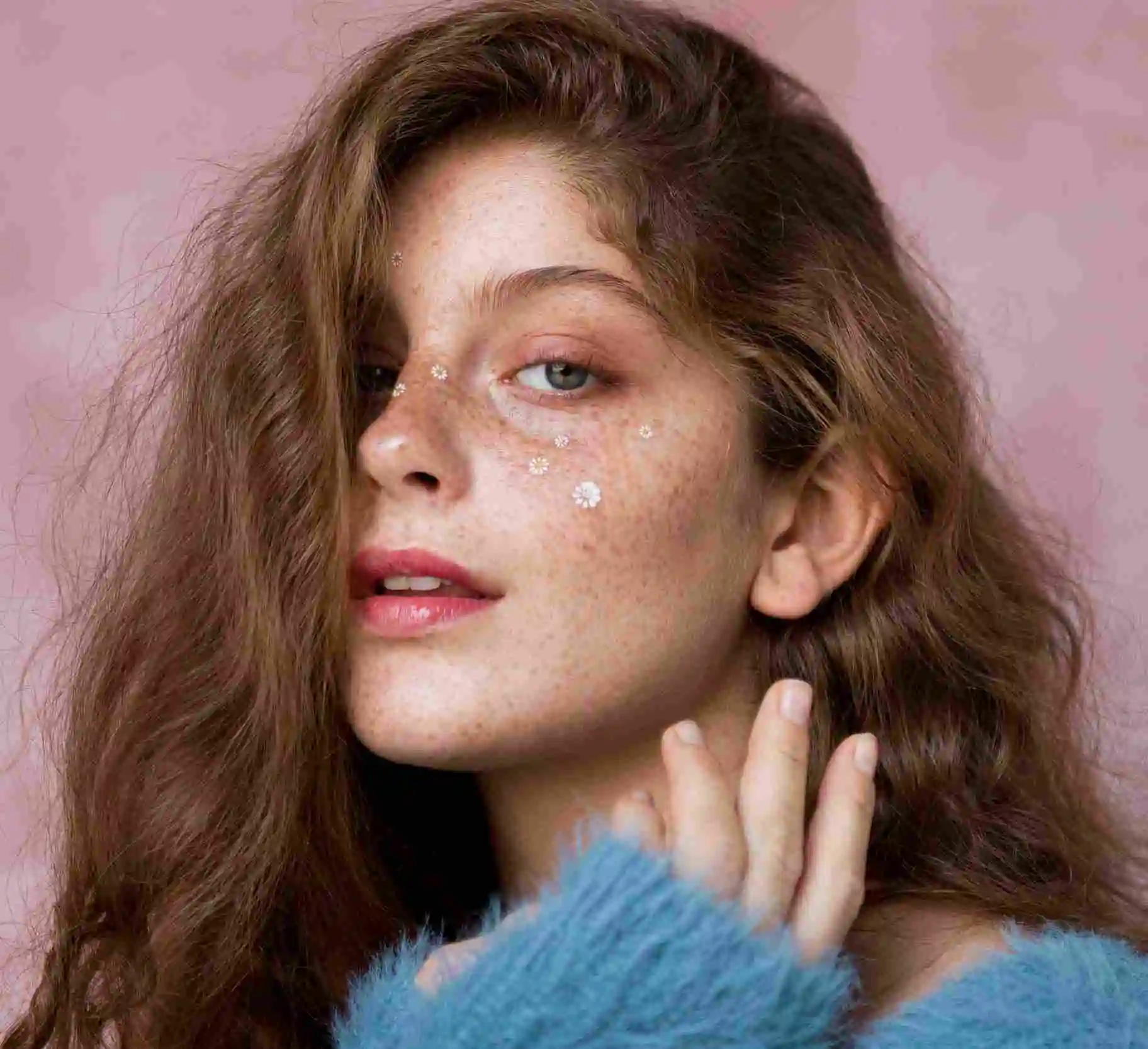 Freckles and Blemishes Treatment in Riyadh 2 Melasma Treatment