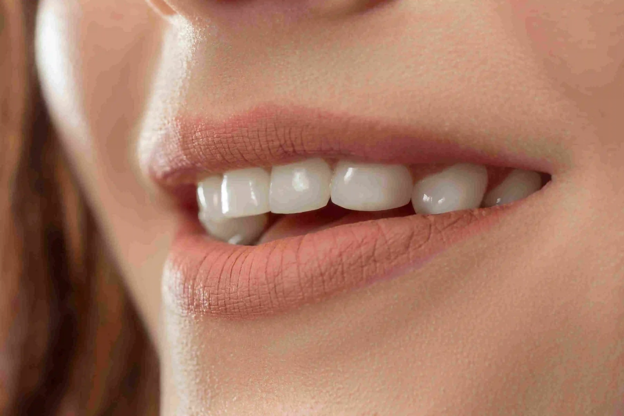 Best Dentist in Riyadh 4 Overlapping Teeth Cost in Riyadh