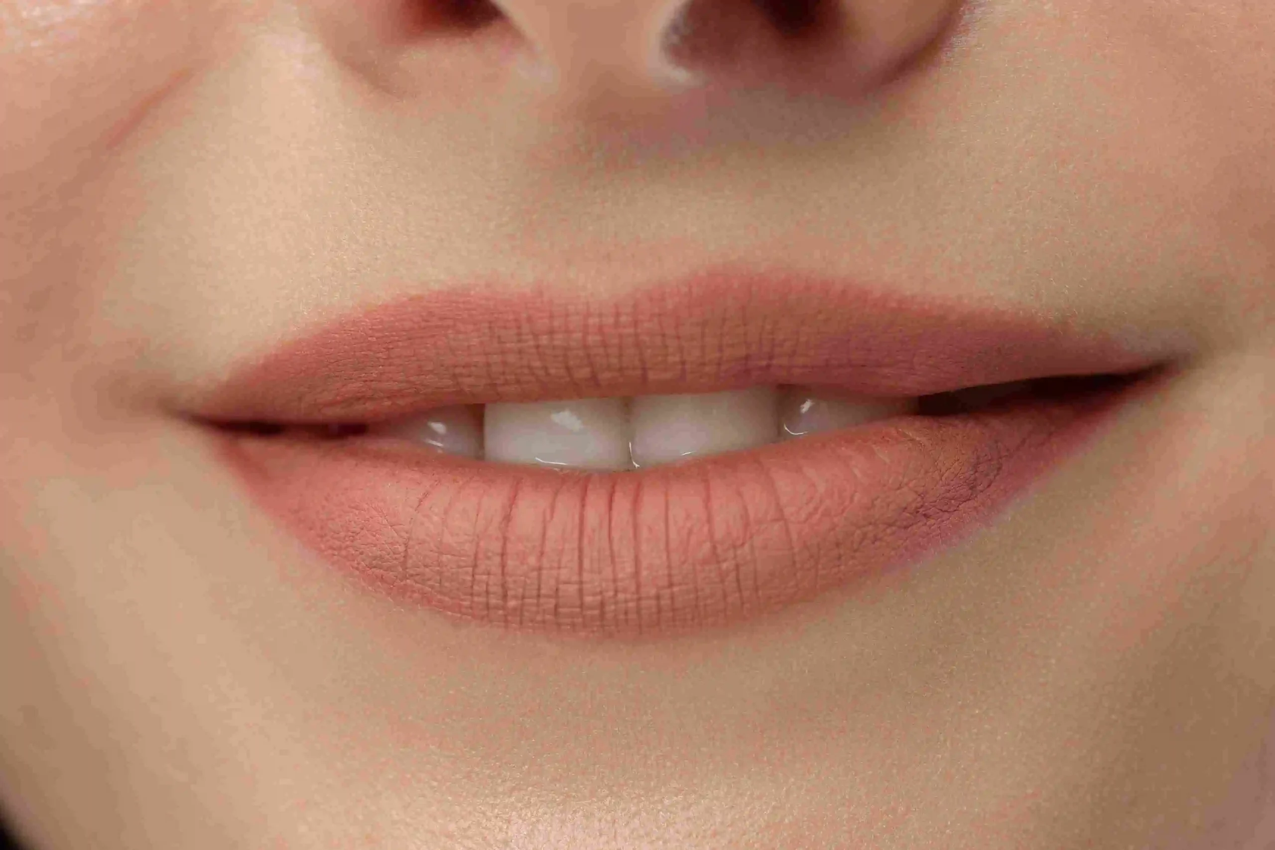 Lip Reduction in Riyadh 3 lIP rEDUCTION sURGERY cOST IN rIYADH