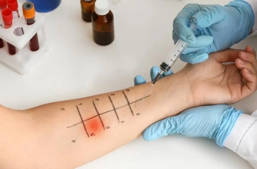 Food Intolerance and Allergy Testing in Riyadh 4 Food Intolerance and Allergy Testing Price in Riyadh