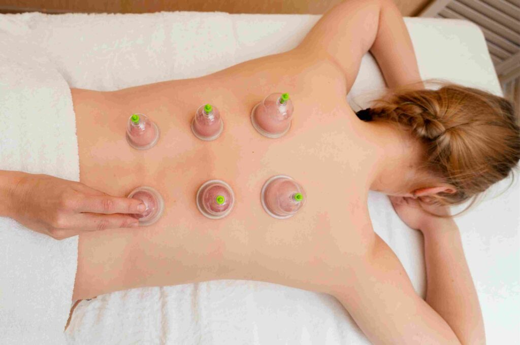 Hijama Treatment in Riyadh 1 Hijama Procedure