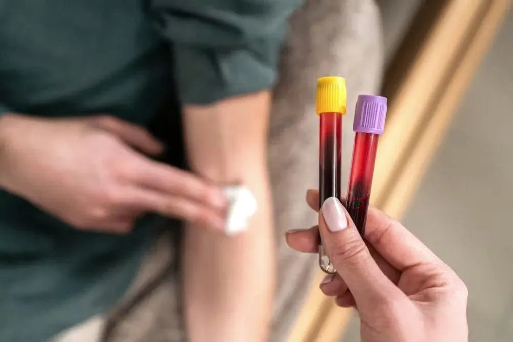 Food Intolerance and Allergy Testing in Riyadh 3 Affordable Blood Tests at Home in Riyadh