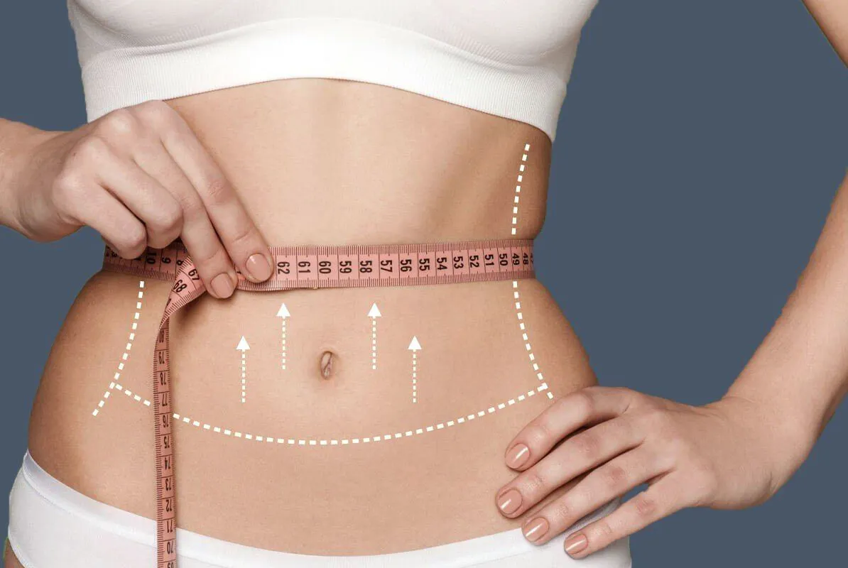 Liposuction in Riyadh 3 Lipoabdominoplasty in Riyadh