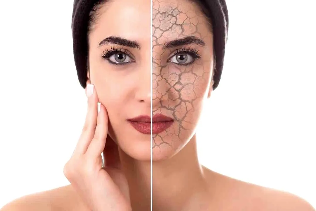 VISIA Skin Analysis in Riyadh 4 VISIA Skin Analysis Cost in Riyadh