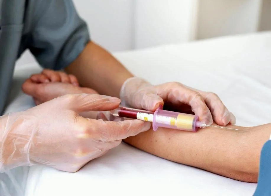 Blood Test for Body Analysis at Home in Riyadh 1 How is the Blod Test Procedure done