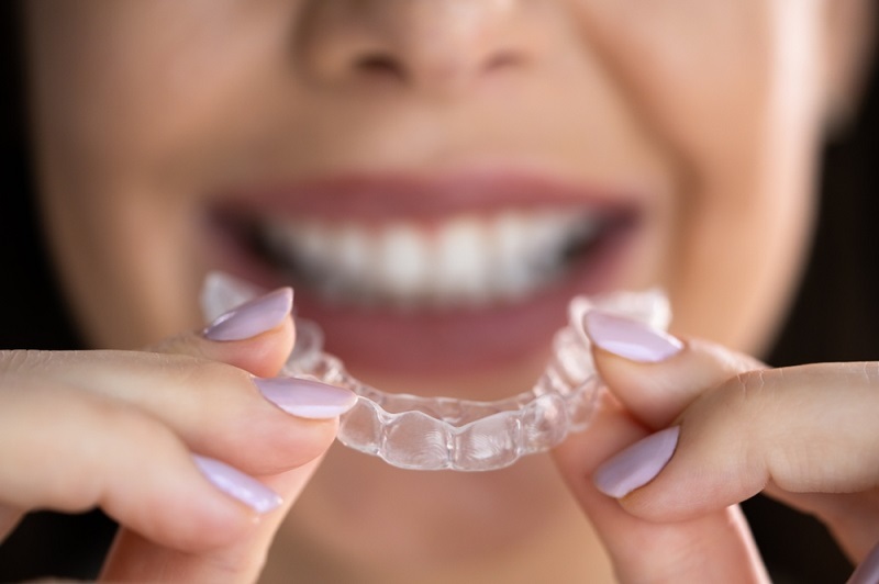 Dental Clinic Riyadh 1 My Experience With the Dental Night Guard