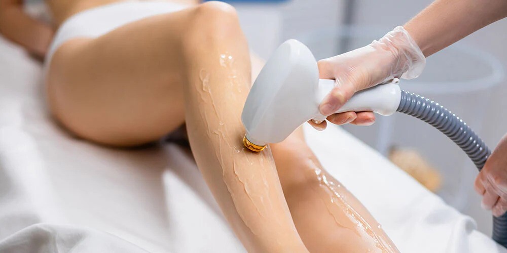 Laser Hair Bleaching in Riyadh 1 best Laser Hair Removal in Riyadh