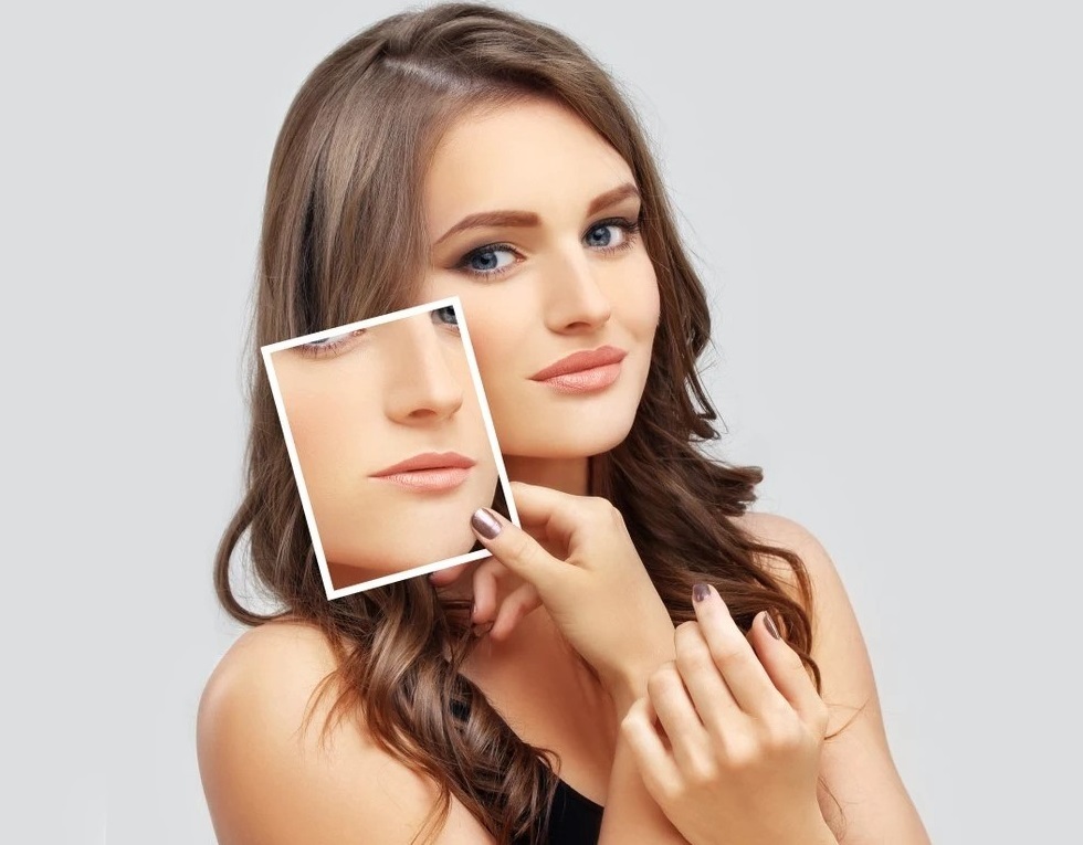 LIP FILLERS in Riyadh | Saudi Arabia 2 lipfiller results