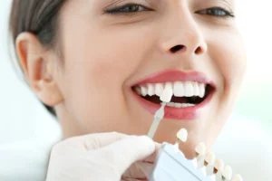 Non-prep veneers in Riyadh price