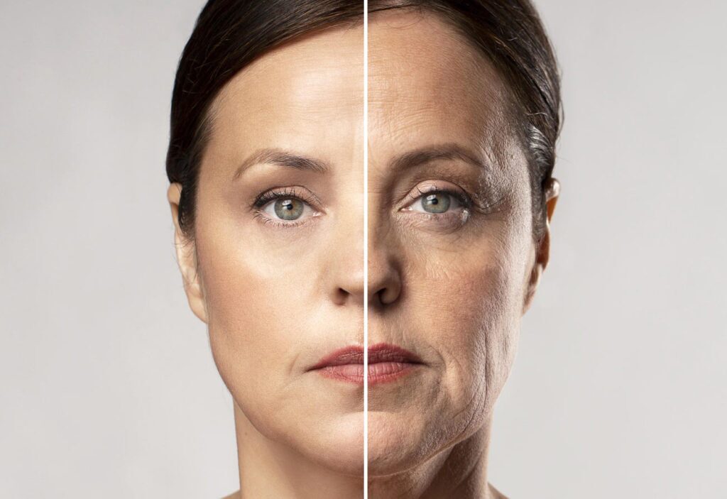 Anti-Aging Treatment in Riyadh 2 anti aging before after results